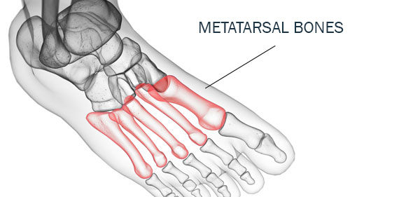 metatarsal bones